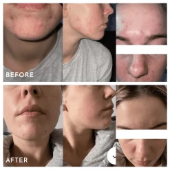 Aspect Extreme B 17 18 Aspect Extreme B 17 -Care Product Shop AspectExtremeB17BeforeAndAfters