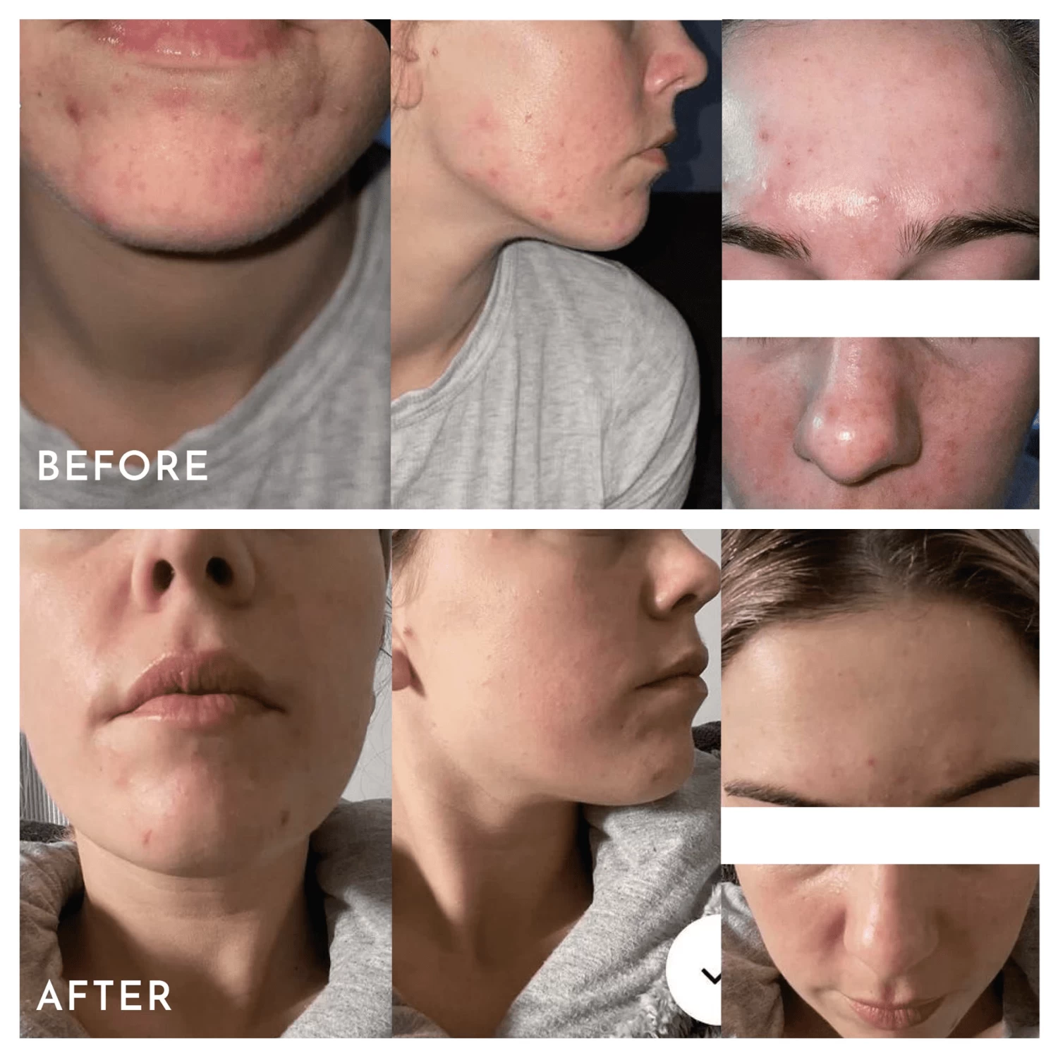 Aspect Extreme B 17 8 Aspect Extreme B 17 - Image 6