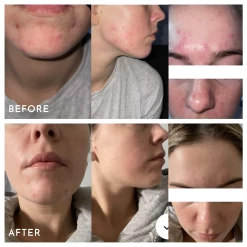 Extreme B17 23 Extreme B17 -Care Product Shop AspectExtremeB17BeforeAndAfters b1a0cecd d7e1 4147 862c 3b14d68fbce8