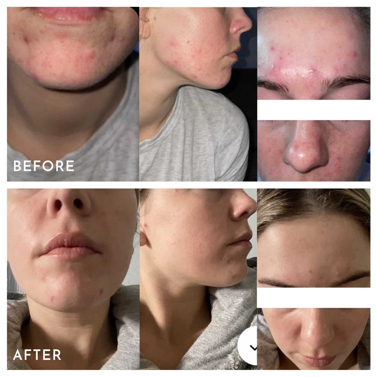 Extreme B17 10 Extreme B17 - Image 8