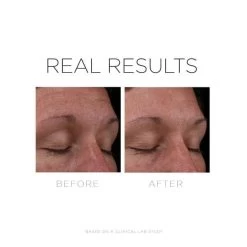 Cosmedix Serum 16 15 Cosmedix Serum 16 -Care Product Shop CosmedixSerum16beforeandafter