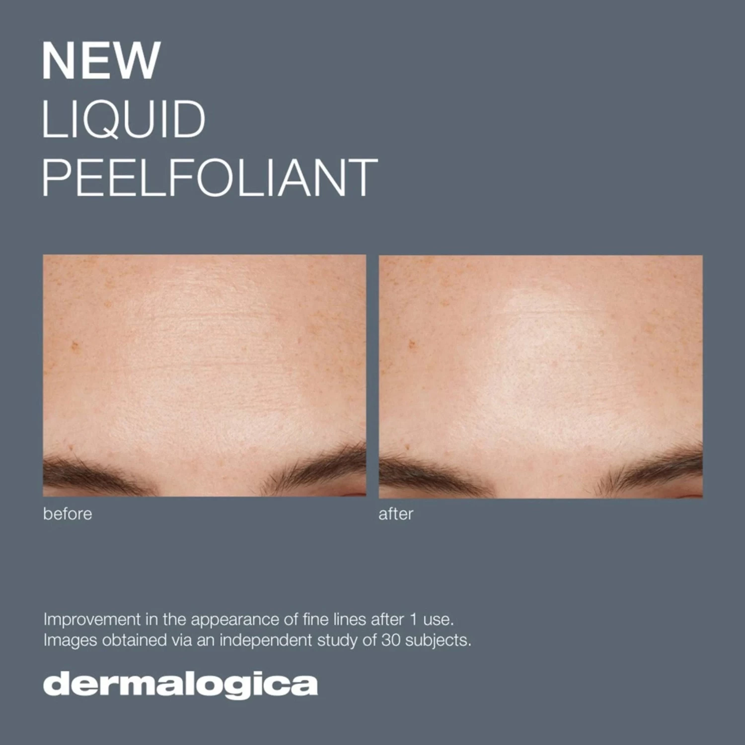 Dermalogica Liquid Peelfoliant 10 Dermalogica Liquid Peelfoliant - Image 8