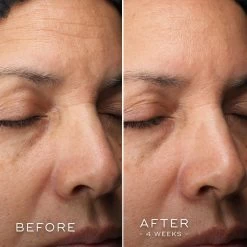 Medik8 C-Tetra Luxe 20 Medik8 C-Tetra Luxe -Care Product Shop Medik8C TetraLuxeBefore After