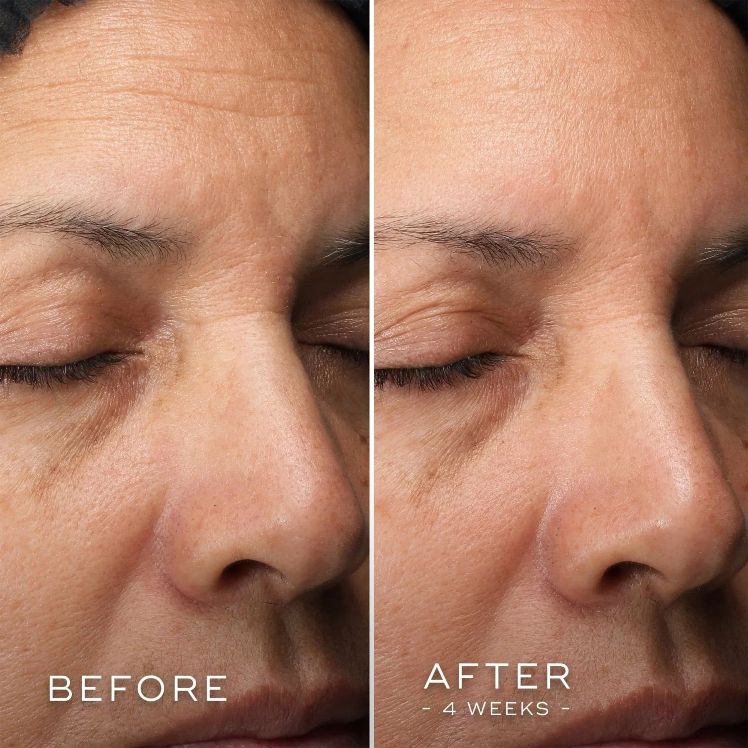 Medik8 C-Tetra Luxe 7 Medik8 C-Tetra Luxe - Image 5