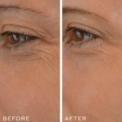 Medik8 Crystal Retinal 1 18 Medik8 Crystal Retinal 1 -Care Product Shop Medik8CrystalRetinal1beforeandafter