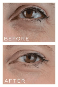 Medik8 Crystal Retinal 3 -Care Product Shop Medik8CrystalRetinal3beforeandafter