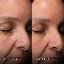 Medik8 H.E.O Mask -Care Product Shop Medik8H.E.OMaskBefore After