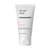 Mesoestetic Fast Skin Repair -Care Product Shop MesoesteticPostProcedureFastSkinRepair 8ac84428 2614 4e25 84d3 cf5d67863dce