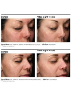 PCA Skin HydraMatte -Care Product Shop PCASkinHydraMatteOnline