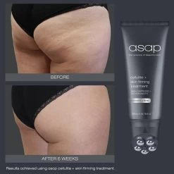 Asap Cellulite And Skin Firming Treatment 15 Asap Cellulite And Skin Firming Treatment -Care Product Shop asapcelluliteandskinfirmingtreatment200ml beforeandafter