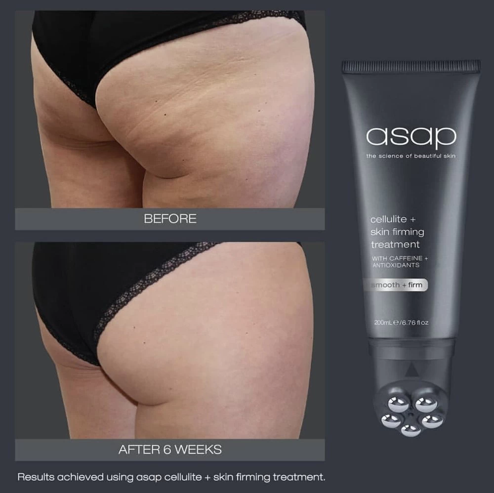 Asap Cellulite And Skin Firming Treatment 7 Asap Cellulite And Skin Firming Treatment - Image 5