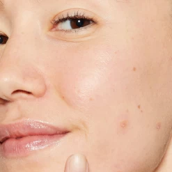 Dermalogica Deep Breakout Liquid Patch 24 Dermalogica Deep Breakout Liquid Patch -Care Product Shop dermalogica acne treatments