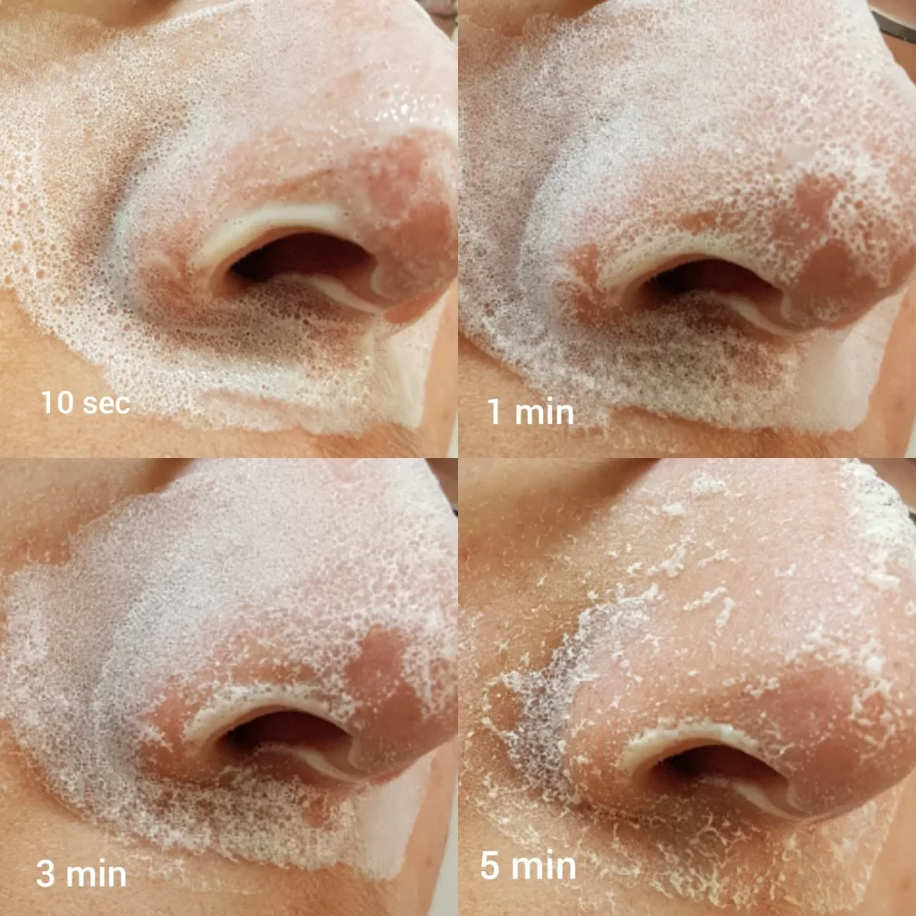 Dermalogica Blackhead Clearing Fizz Mask 19 Dermalogica Blackhead Clearing Fizz Mask - Image 17