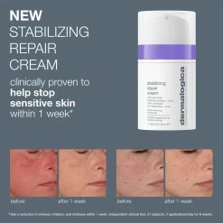 Dermalogica Stabilizing Repair Cream -Care Product Shop dermalogica stabilizing repair cream before and after