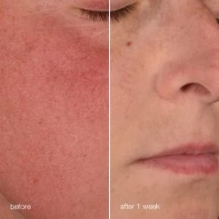 Dermalogica Stabilizing Repair Cream -Care Product Shop stabilizing repair cream